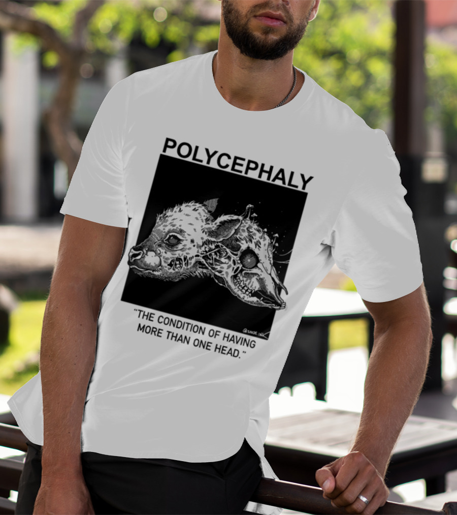 Polycephaly The Condition Of Having More Than One Head T-Shirt