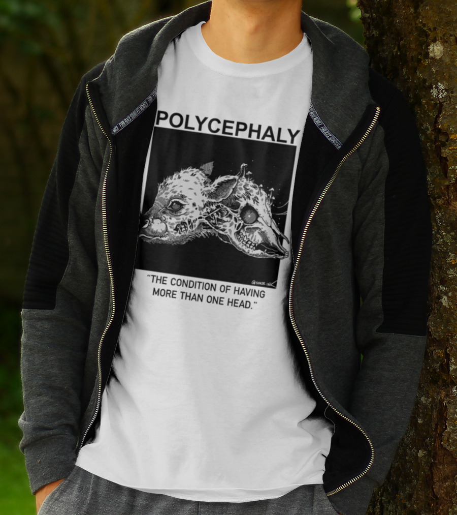 Polycephaly The Condition Of Having More Than One Head T-Shirt