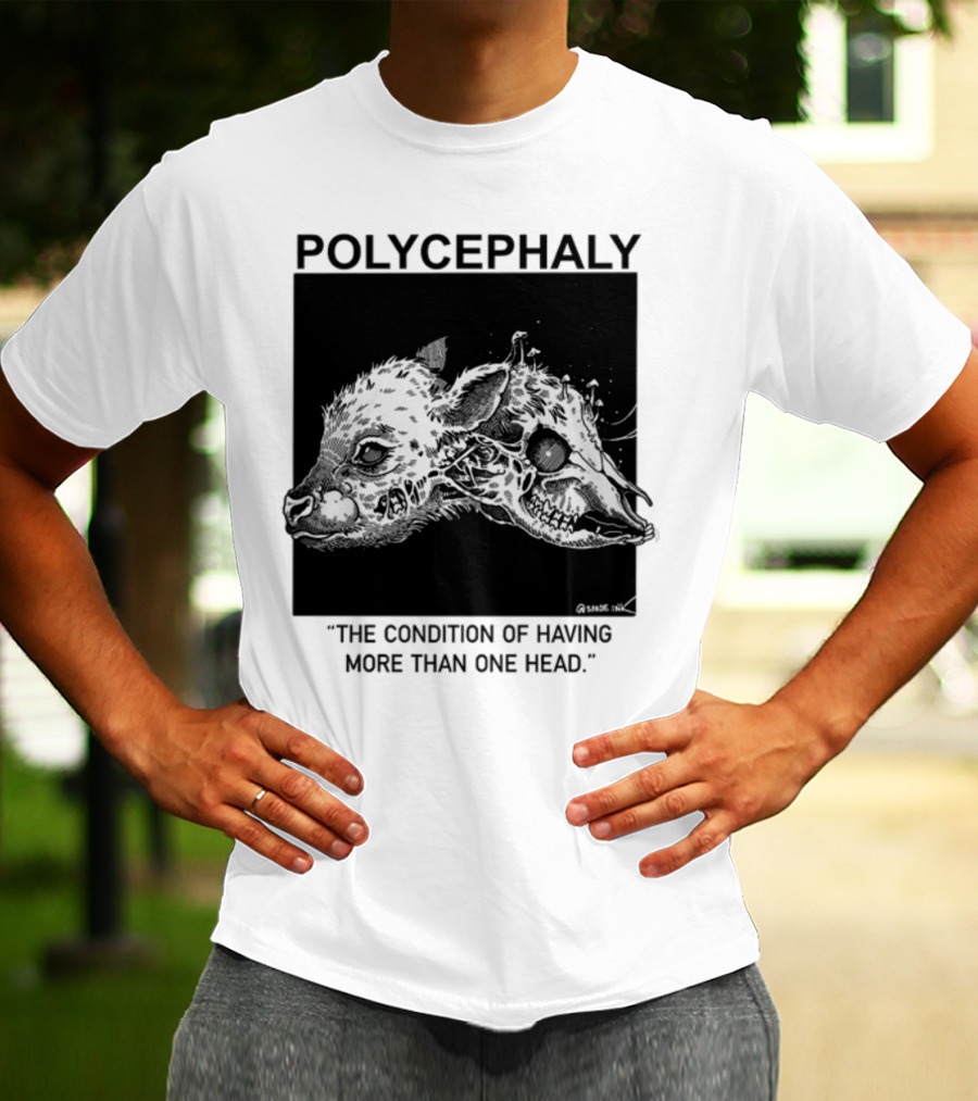 Polycephaly The Condition Of Having More Than One Head T-Shirt