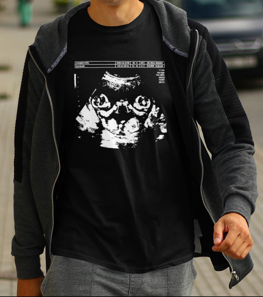 Julian And Logan Congrats Your Having Big Backs T-Shirt