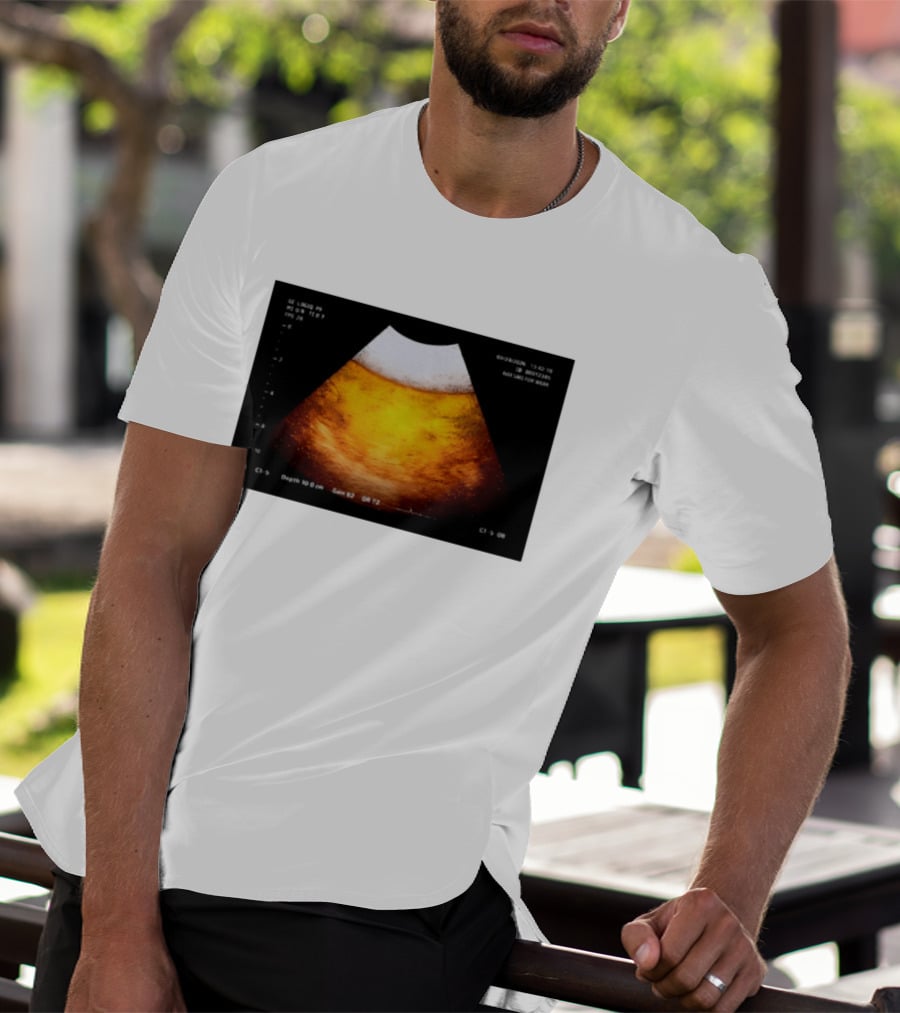 Beer Ultrasound Image Not Safe For Liver T-Shirt
