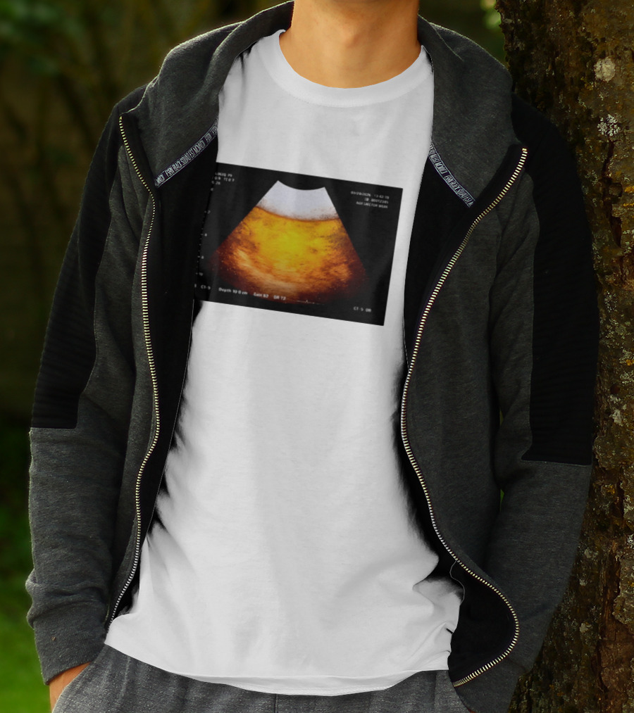 Beer Ultrasound Image Not Safe For Liver T-Shirt