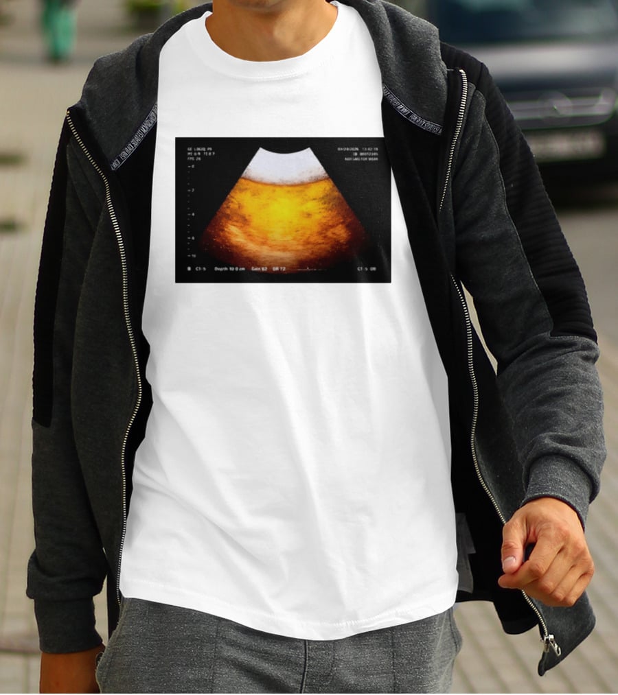 Beer Ultrasound Image Not Safe For Liver T-Shirt