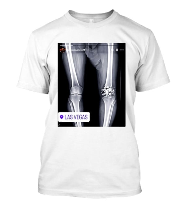 Conor McGregor X Ray Broken Knee Las Vegas T-Shirt