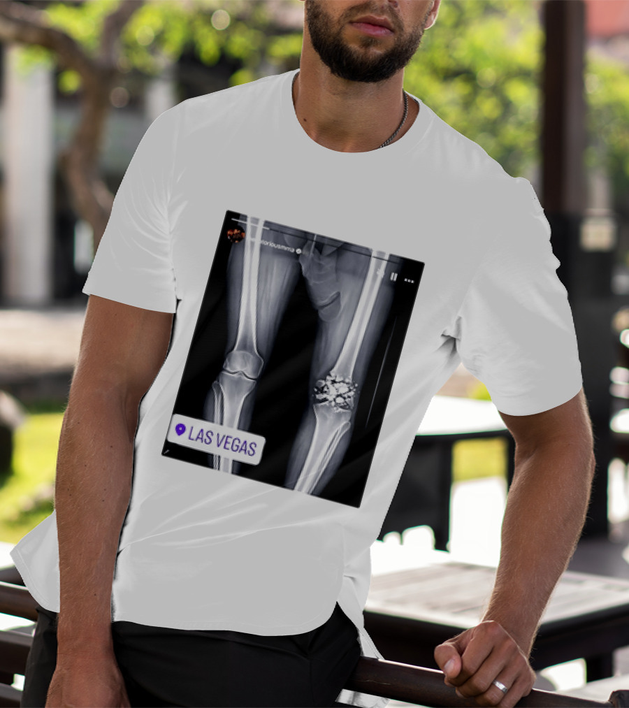 Conor McGregor X Ray Broken Knee Las Vegas T-Shirt