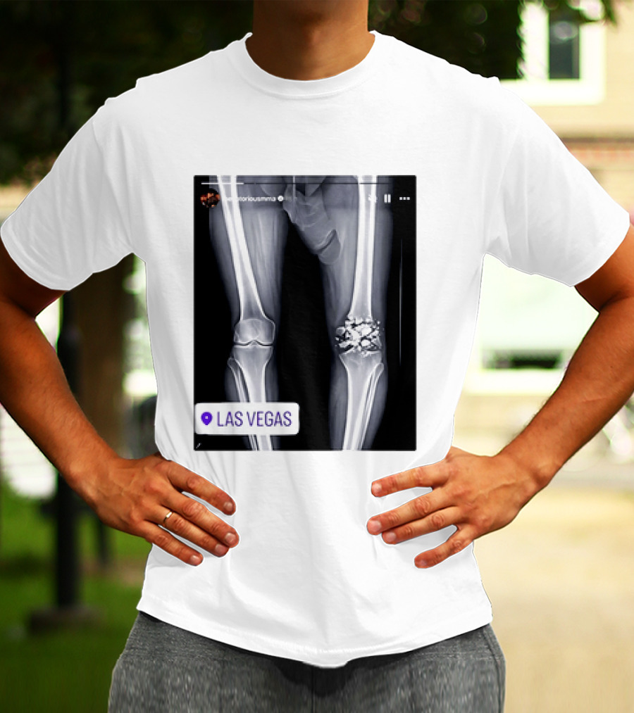 Conor McGregor X Ray Broken Knee Las Vegas T-Shirt
